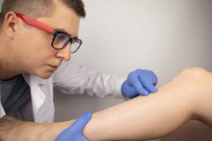 Bone Contusion: Causes, Symptoms, and Treatments