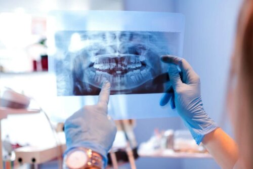 orhtodontist looking at x ray of mouth