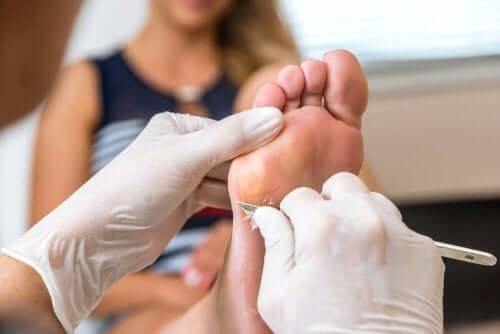 A podiatrist removing a callus from a woman's foot.