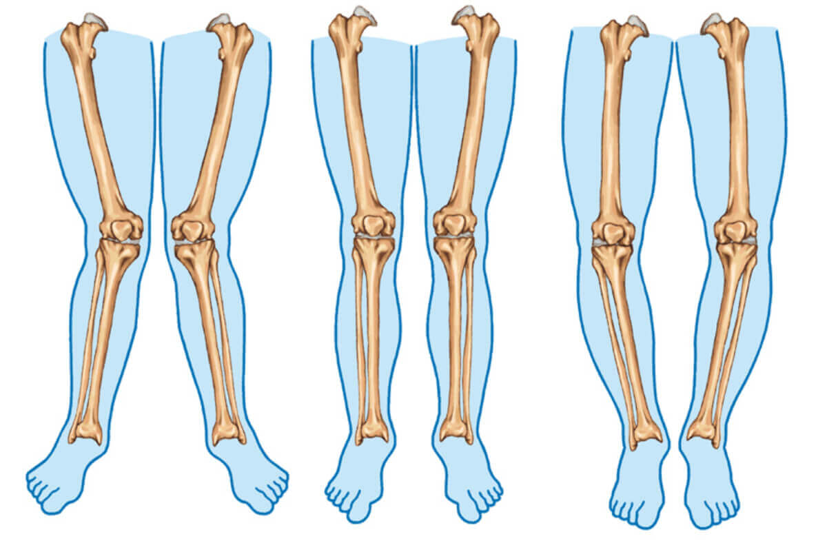 Different types of legs.