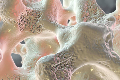 Close up of a weak bone structure