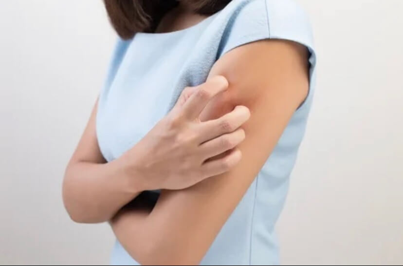 Atopic Skin: What Is It and What Causes It?