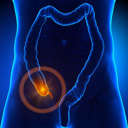 A human intestine.
