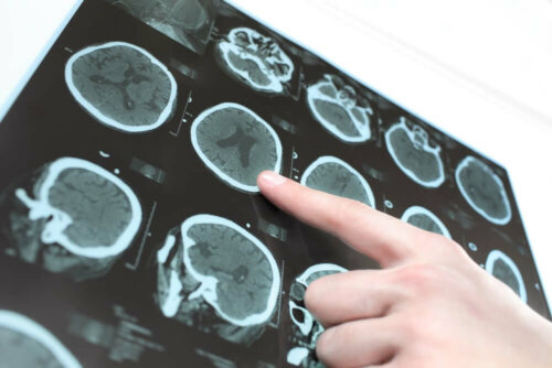 A person pointing at an image on a CT scan.