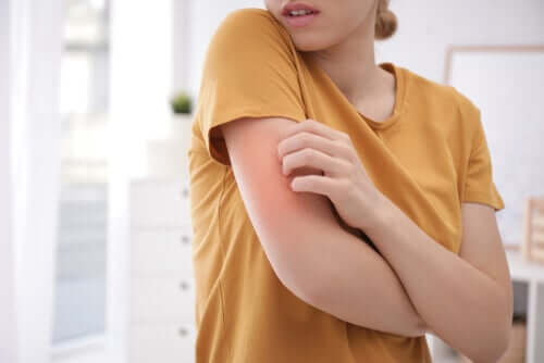 Winterpflege für atopische Haut - Frau kratzt sich am Arm