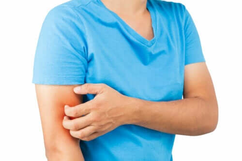 All About Lichen Planus