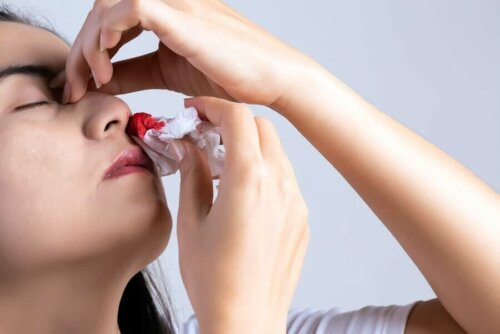En kvinde, der forsøger at stoppe næseblod