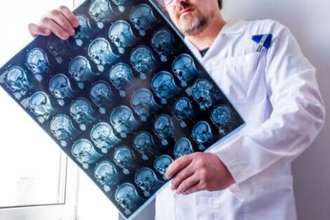 Læge ser på scanninger af hjerne, som er opnået ved hjælp af computertomografi