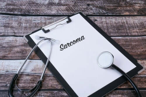 The Origin, Symptoms, and Treatment of Kaposi Sarcoma