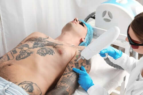 Laser Tattoo Removal: How does It Work on the Skin?