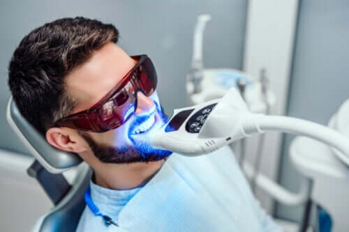How Long does Teeth Whitening Last?