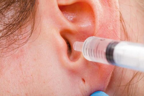 Ohrenschmalzblockade: Entfernung beim Arzt
