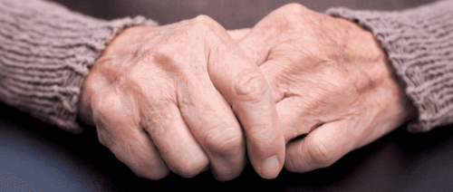 Nærbillede af hænder på en person med Parkinsons