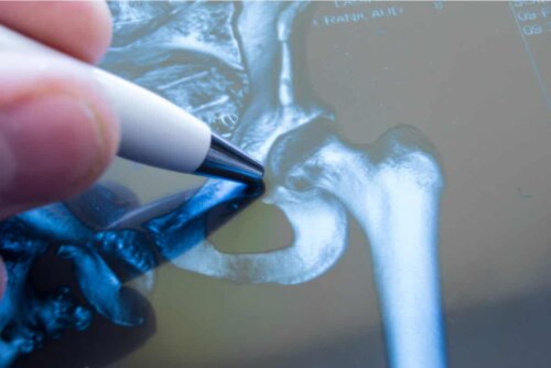 An imaging procedure.