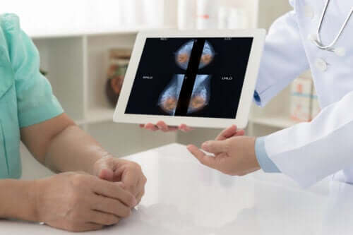 What is Breast Reconstruction and When is it Recommended?