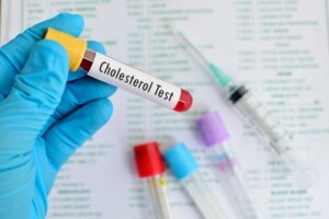 HDL and LDL Cholesterol: Everything You Need to Know