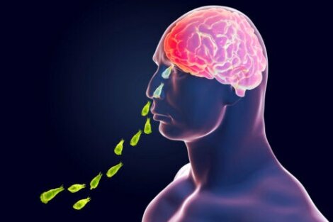 Naegleria Fowleri Infection: The Brain-eating Amoeba