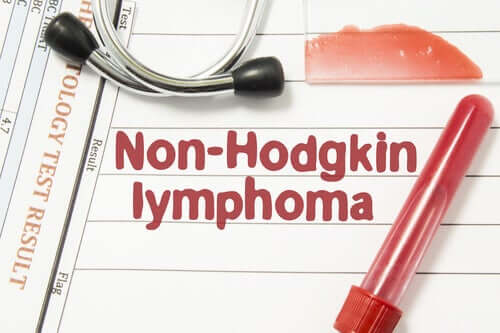 Non-Hodgkin's Lymphoma: Everything You Need to Know
