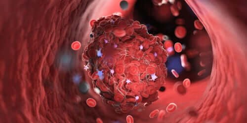 What Do You Know About Xarelto?