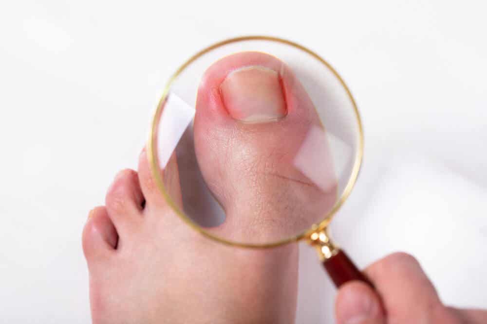 A swollen toe under a magnifying glass.