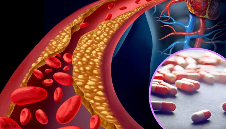 Hyperlipidemia: Elevated Lipid Levels in the Blood Step To Health Hyperlipidemia: Elevated Lipid Levels in the Blood Step To Health
