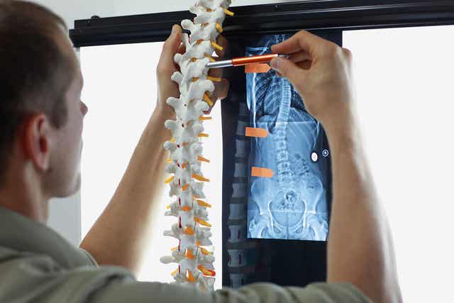 Læge ser på røntgen af rygrad