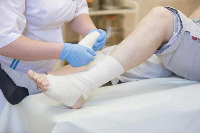 En læge lægger gips på patient