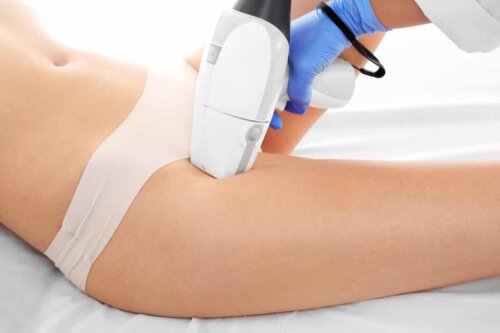 A woman undergoing hair removal.