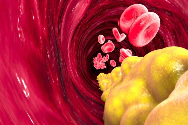 Ätherisches Bergamotteöl - Cholesterin im Blutkreislauf.