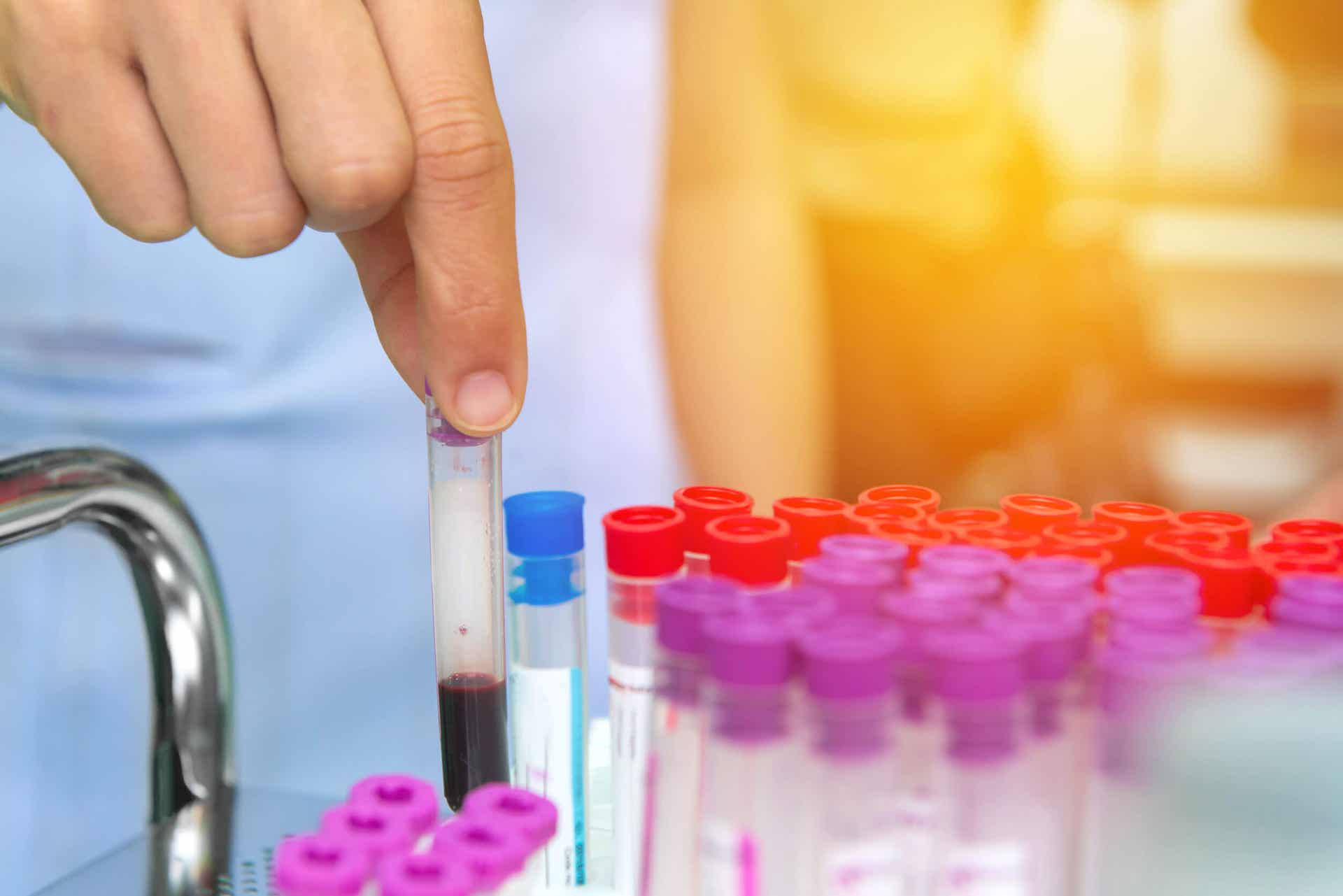 Person tager blodprøve