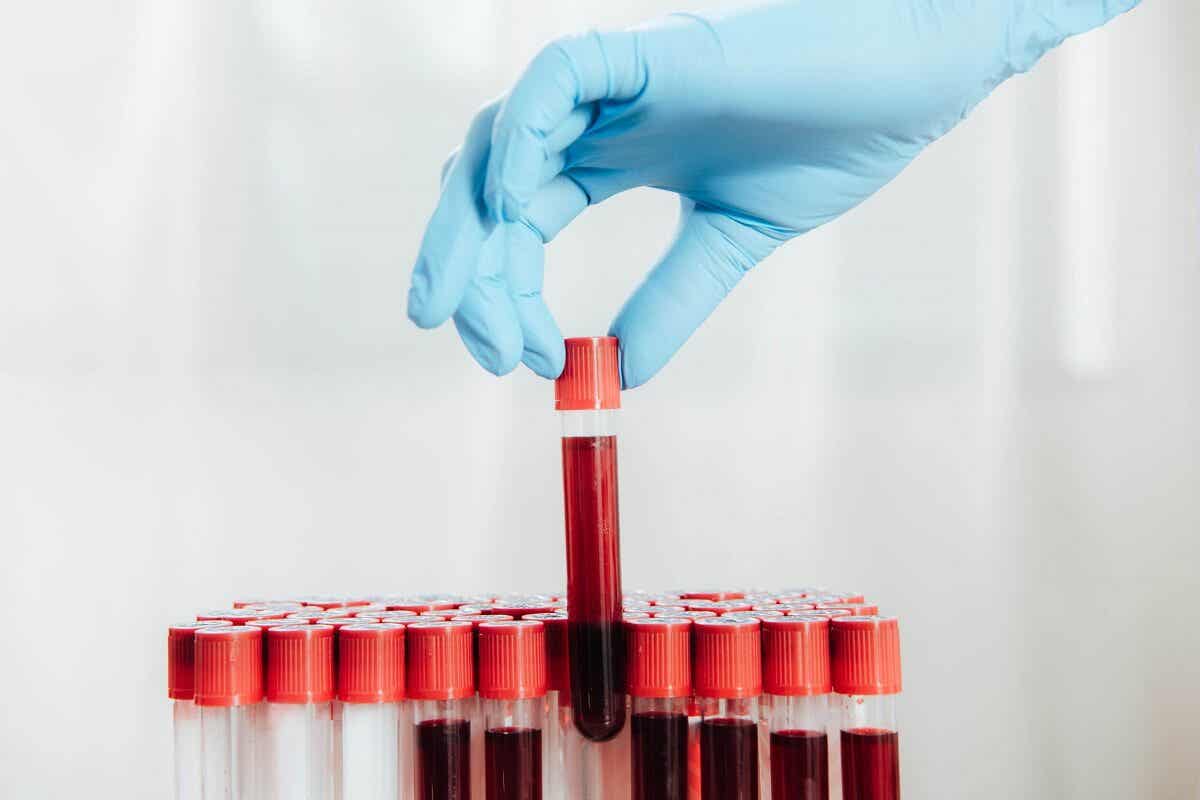Person tager fat i blodprøver