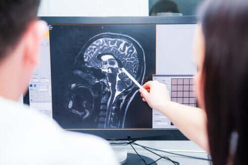 Early Signs of Multiple Sclerosis