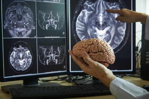 En lege som peker på en skjerm på en hjerne.