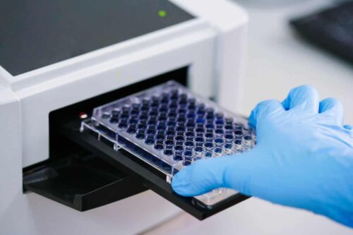 Laborant udfører test af antinukleære antistoffer