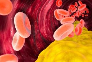 Is VLDL Cholesterol Harmful?