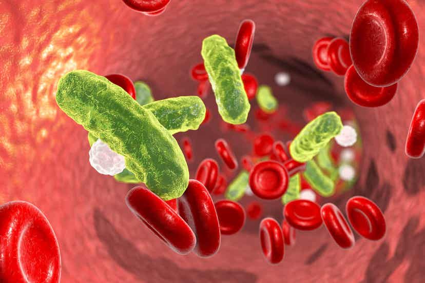 Nekrotisierende Fasziitis - Bakterien im Blut