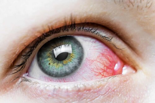 Augentrost - Nahaufnahme eines roten Auges