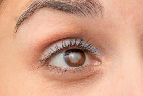 Augentrost - Nahaufnahme Glaukom