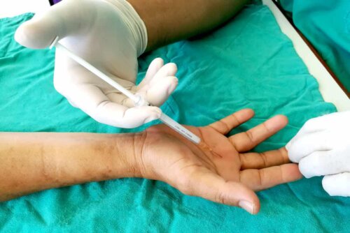 injection into the hand done by a third party