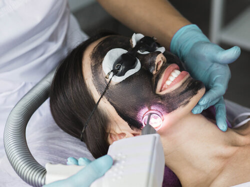 Activated Carbon Laser Peel: Process and Care