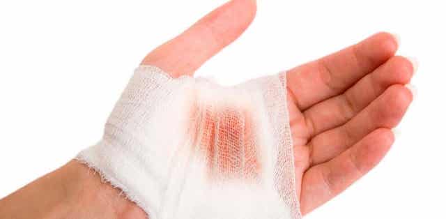 A hand with gauze wrapped around a bleeding wound on the palm.
