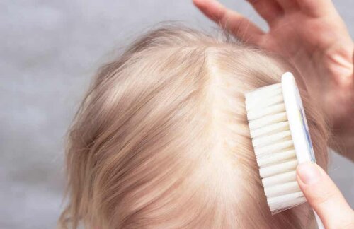 A child's scalp.