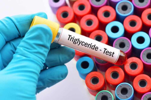 Blodprøve til at tjekke for forhøjede triglycerider