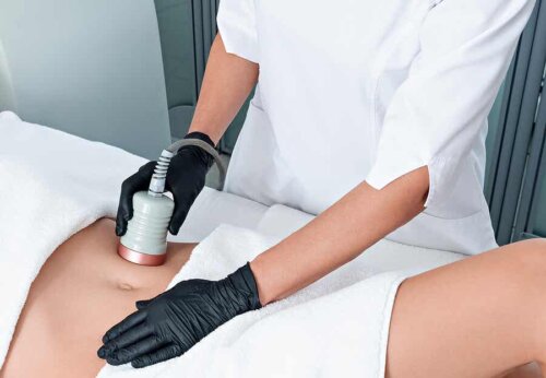 Cavitation κατά της κυτταρίτιδας: Τι είναι και πώς βοηθά