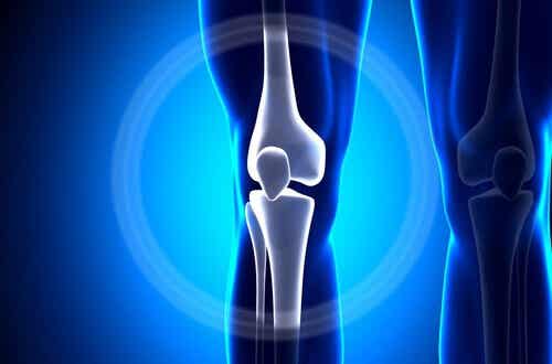 Et røntgenbillede af et knæ