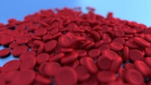 Anemia and Weight Loss