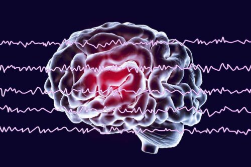 Hjernebølger foran hjerne repræsenterer karakteristika for REM-søvn