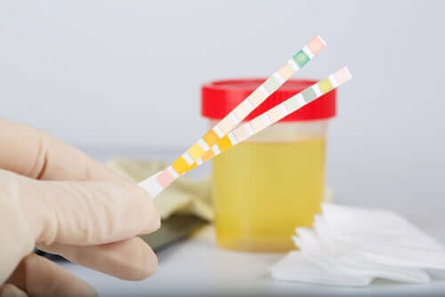 What is Urine pH?