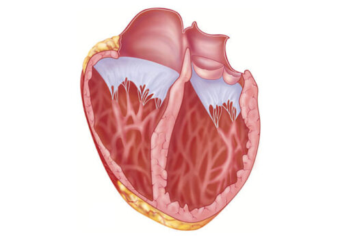 What you Should Know about a Dilated Heart