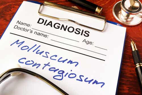 Molluscum contagiosum - Diagnose